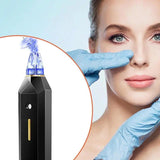 Electric Pore Vacuum with Dark Spot Removal & Oxygen Injection