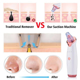 Electric Facial Vacuum Blackhead & Acne Remover with Deep Pore Cleansing
